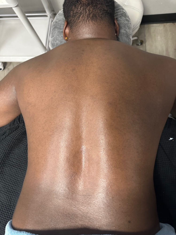 Aromatherapy Back Facial