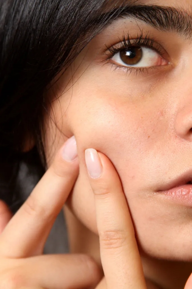 Clarifying Acne 60 Minute Facial