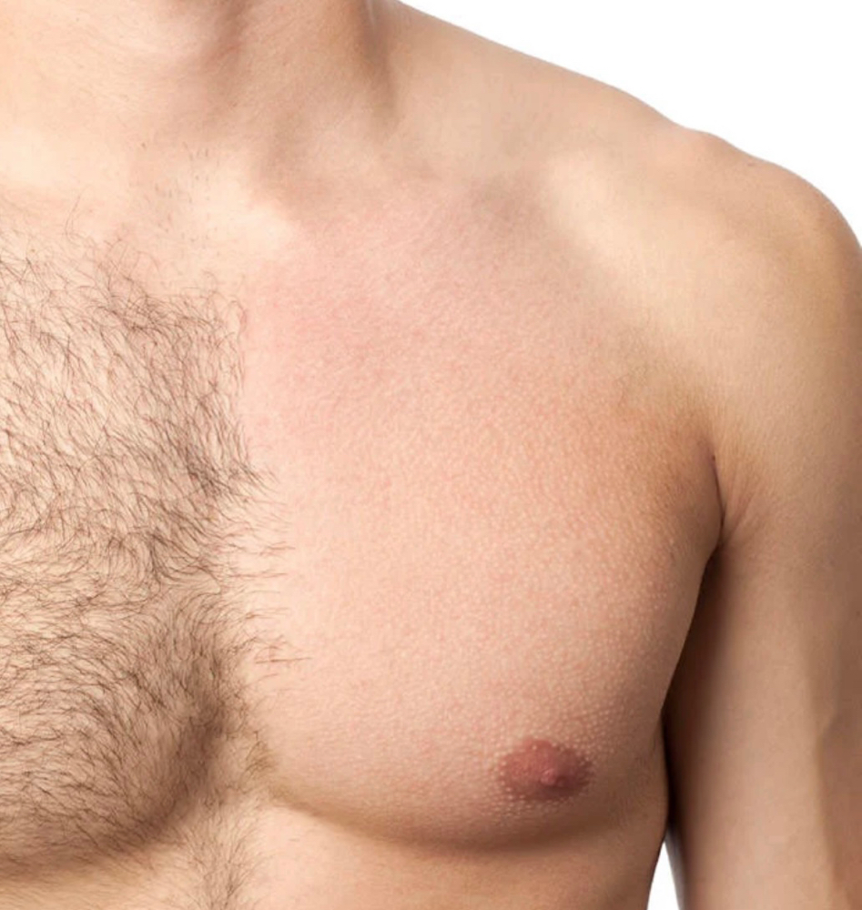Full Chest