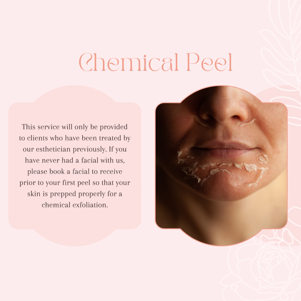 Chemical Peel