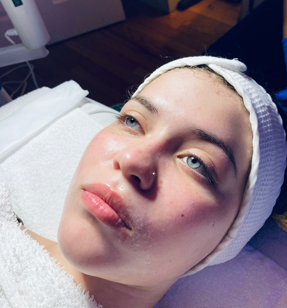 Powerful Detox Facial