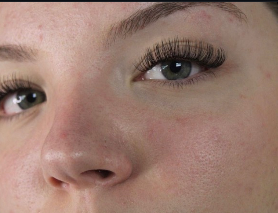 HYBRID FILL IN