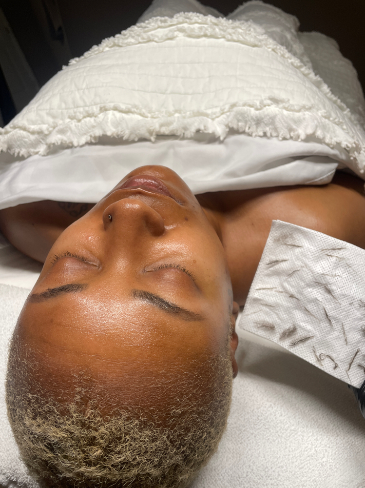 Dermaplaning Facial