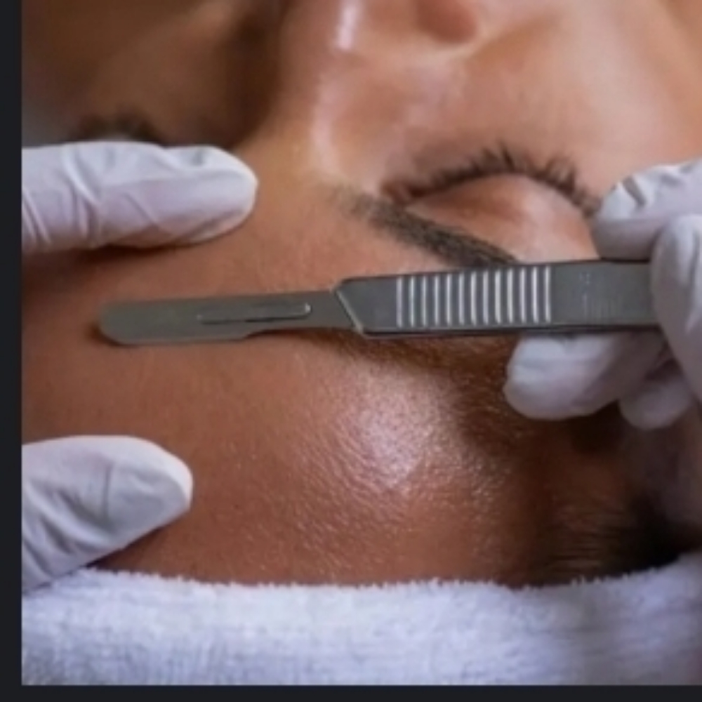 Dermaplaning Facial at Skin & Toxx Medical Spa Westchase in Houston, TX