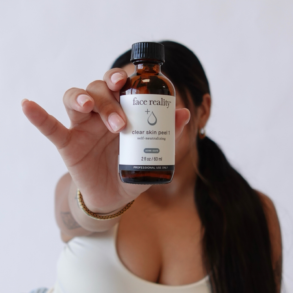 Clear Skin Consult + Treatment at Esthetics with Nichole in Rancho Cucamonga, CA