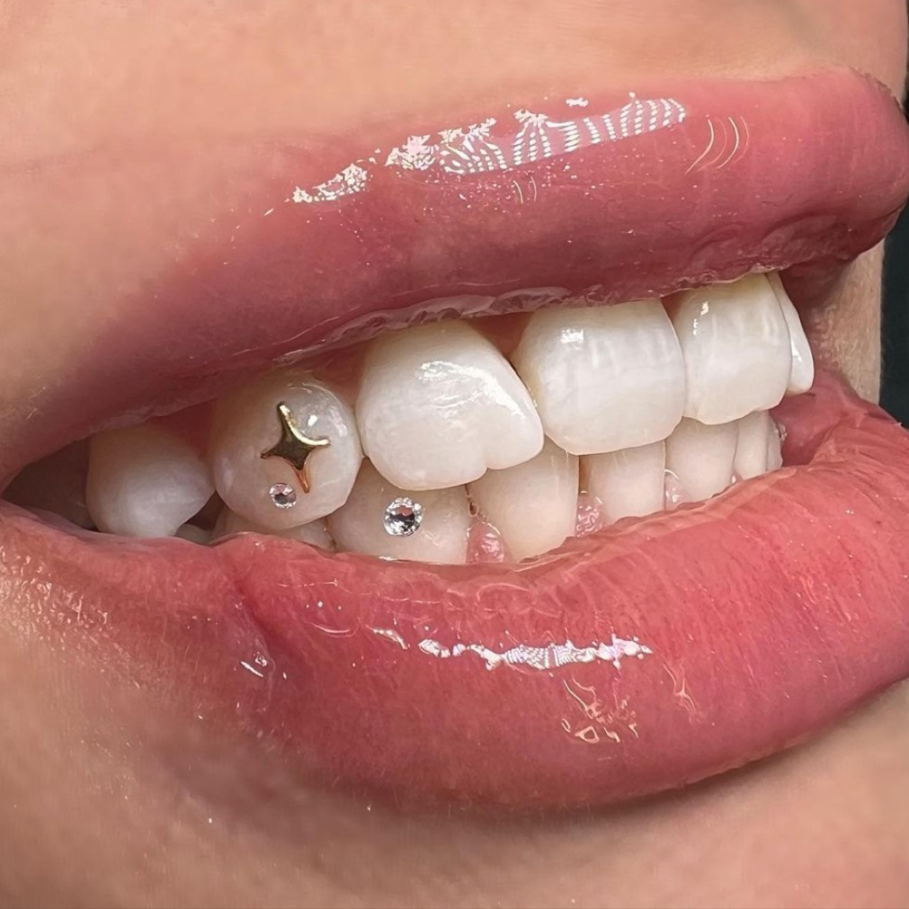 Tooth gems at Hair by Kylie Pence in San Diego, CA