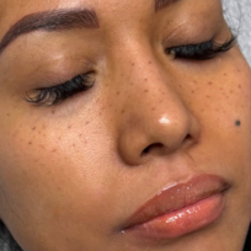 Freckles at Luxury Looks Beauty & Esthetics in Manahawkin, NJ