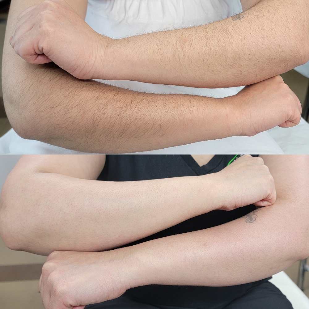 Full Arm Wax