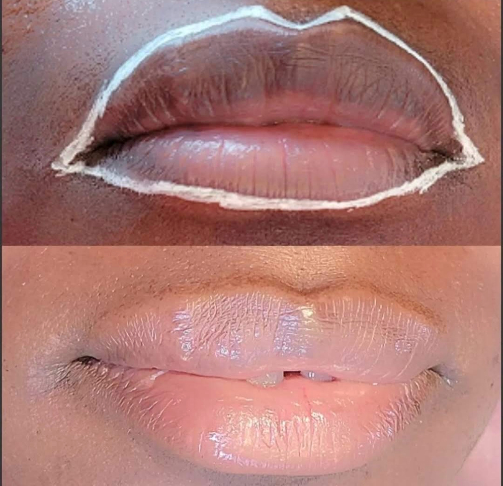 Lip Neutralization