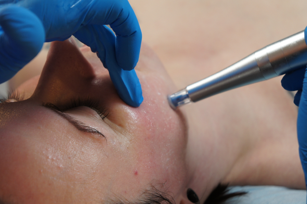 Add-on: Nano-Infusion (Neck)