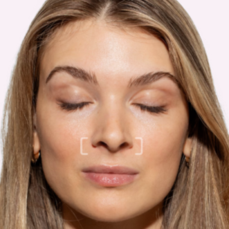 Gummy Smile Tox at Injections by Leighanna in Clarksville, IN