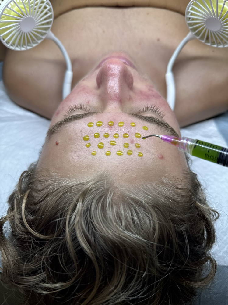 Facial Add On: No Peel Chem Peel at Belle Beauty Haven in Pasadena, CA