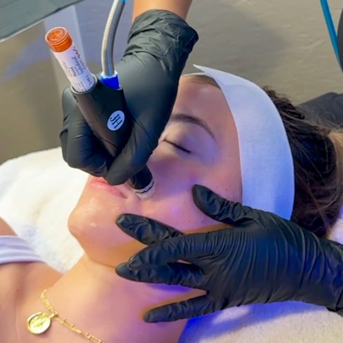 HYDRAFACIALS