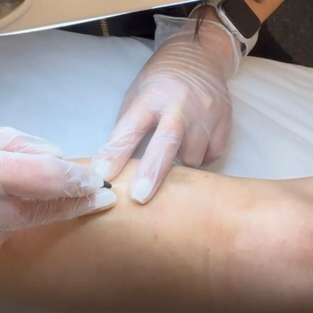 Electrolysis 30 Min Pack (5) at La Belle Studio by Soraya in Woburn, MA