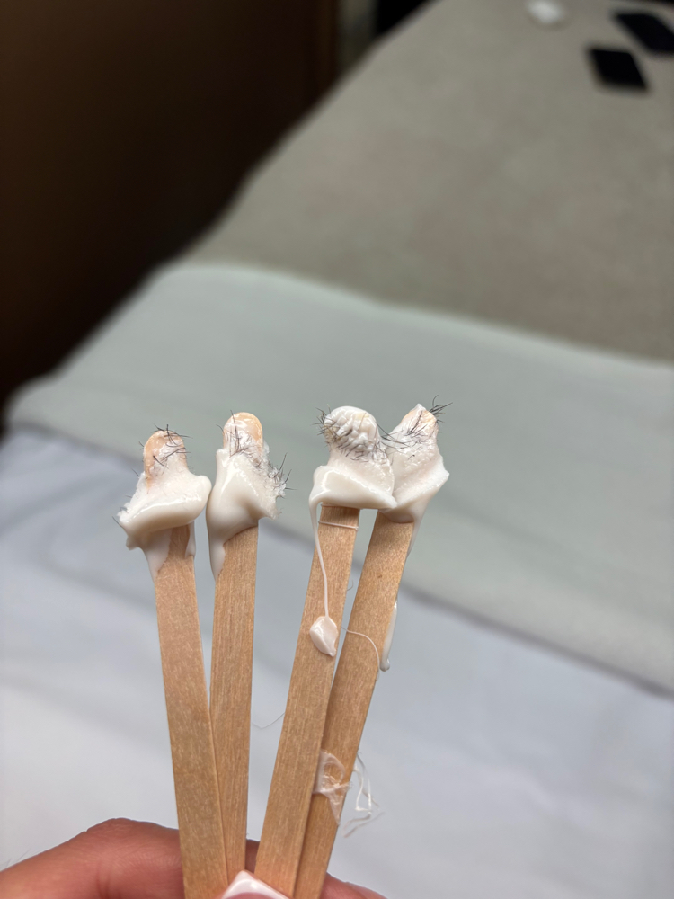 Nose & Ear Wax