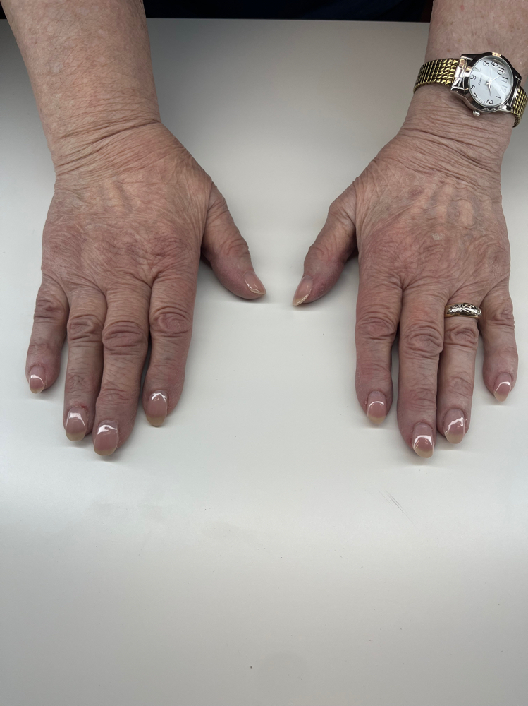Manicure Cleaning