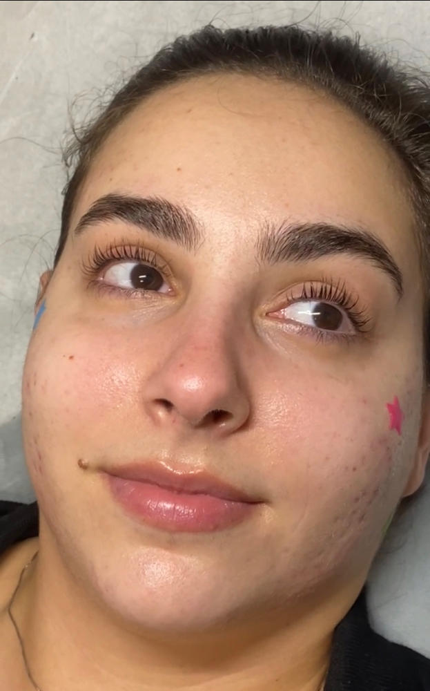 Lash Lift