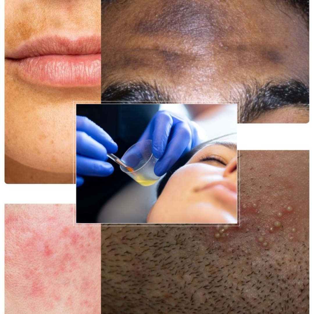 CORRECTIVE TREATMENTS at WilKay Wellness & Aesthetics in Gilbert, AZ