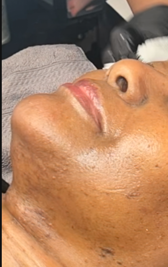 Chin Wax at Spa Treatment by Shannell in Fayetteville, NC