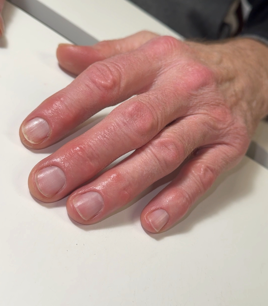 Manicure