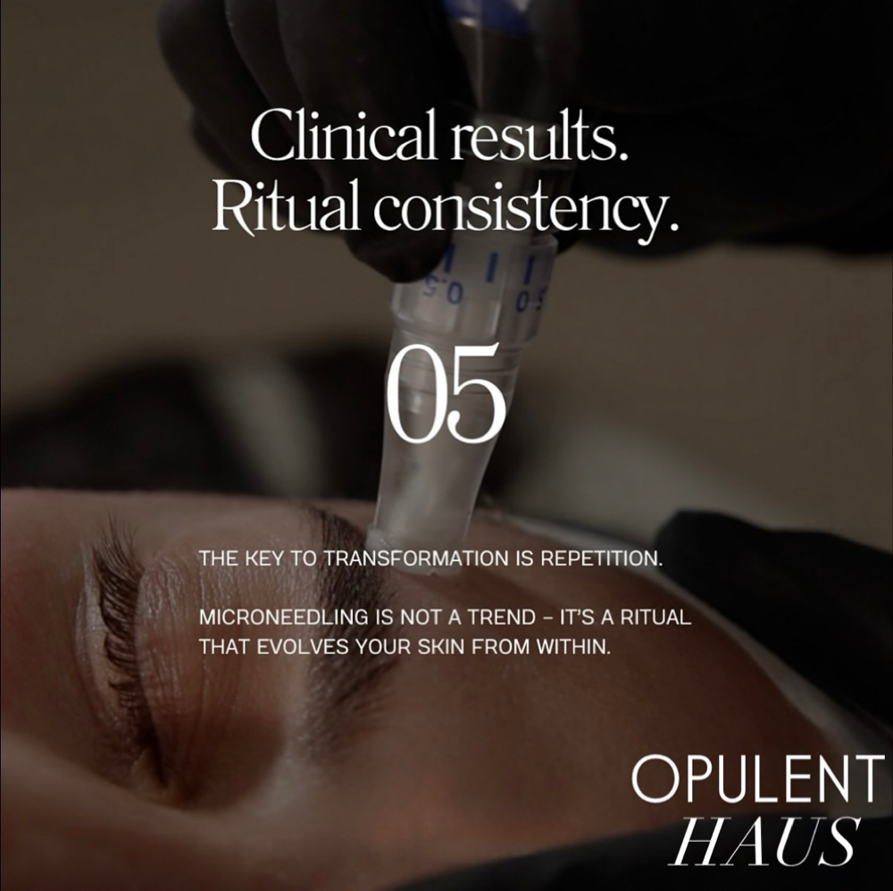 MICRONEEDLING at Opulent Haus | The Skin Co. in Sarasota, FL