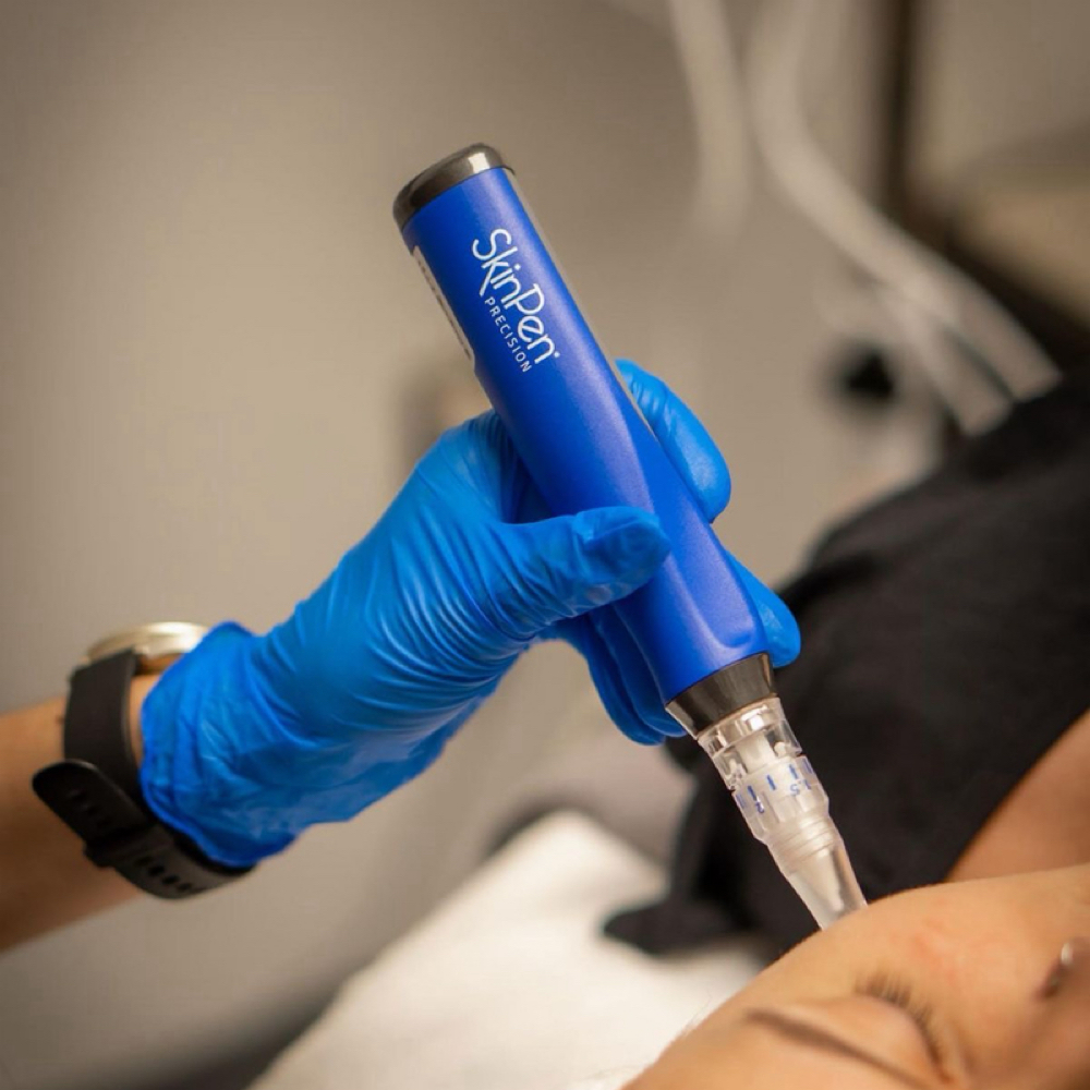 Face Microneedling at J Skin Lab in Hoboken, NJ