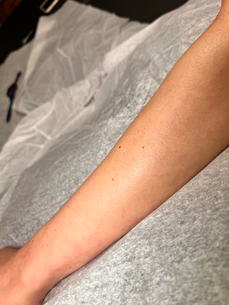 Half Arms at Jessica Fiorentino in Shirley, NY