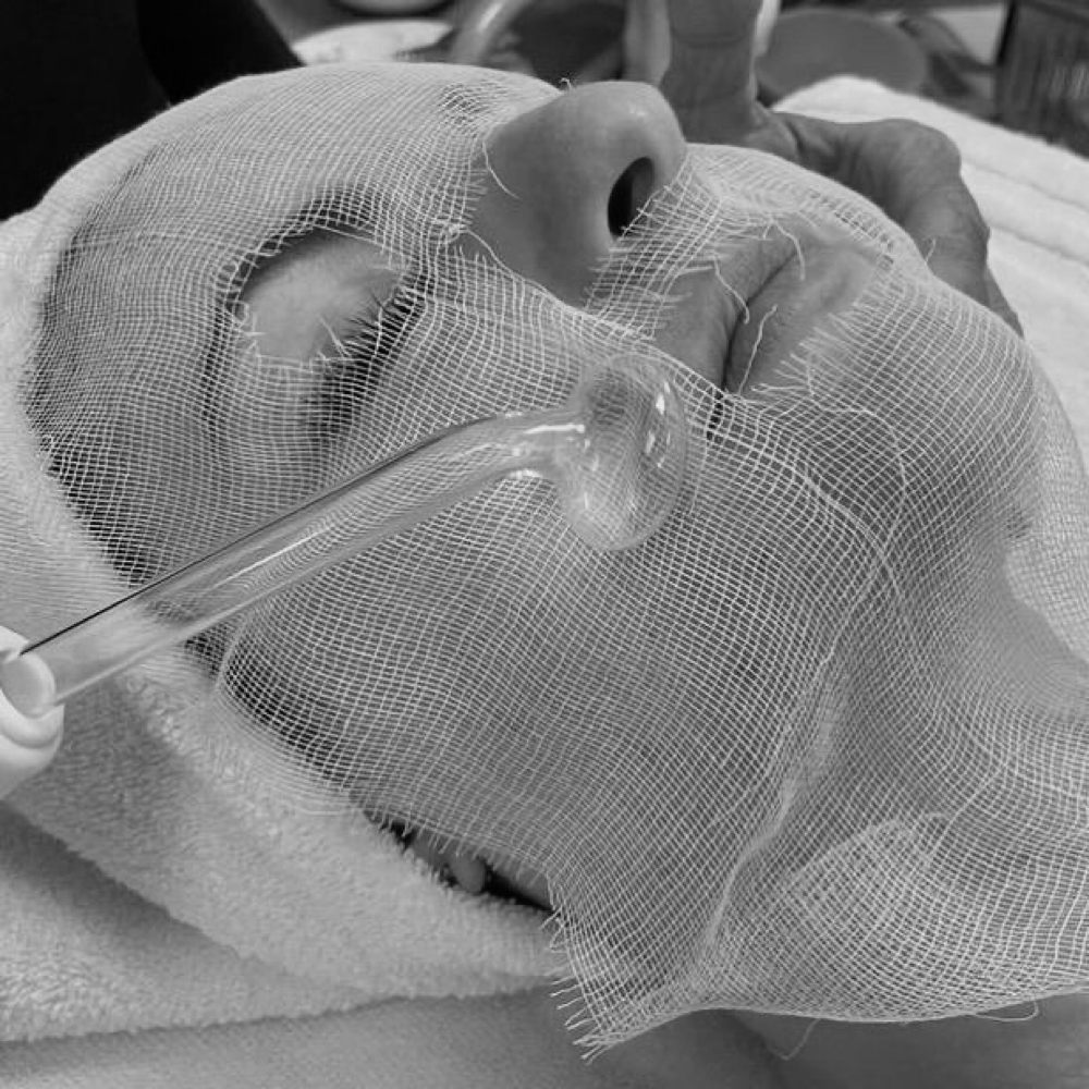 Acne Restoration at Mira Waves Esthetics in Vernon, CT