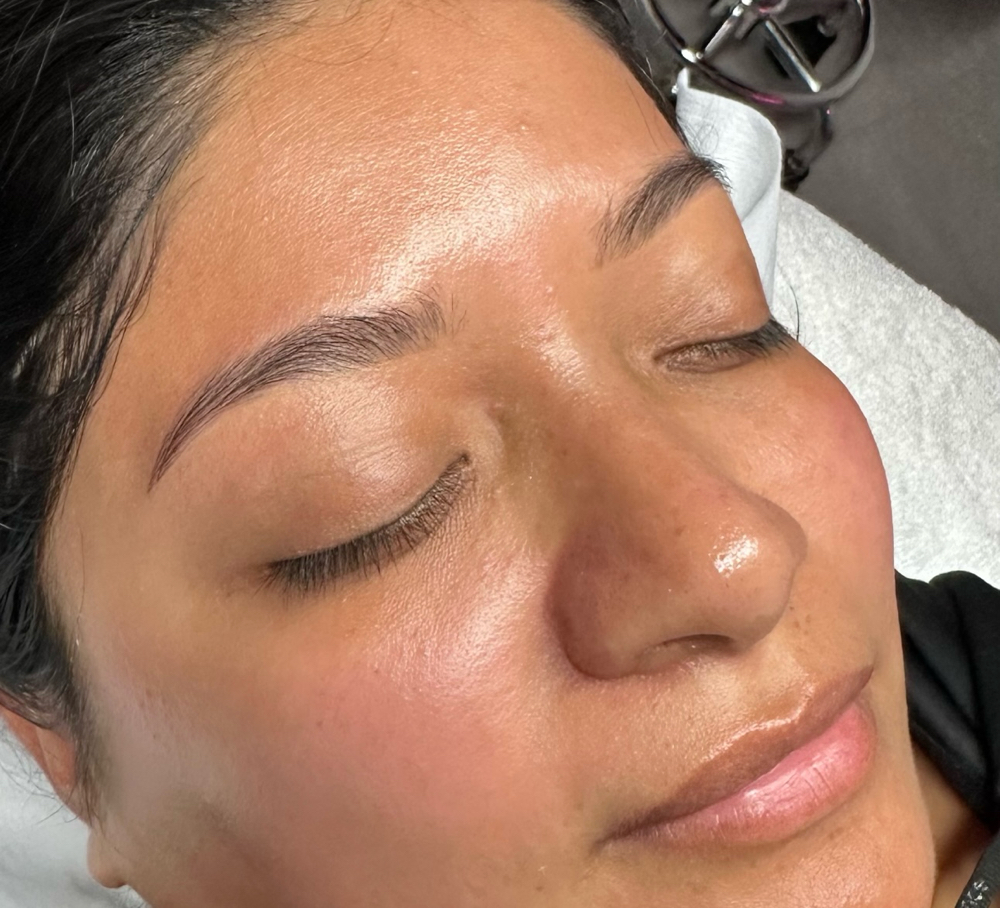 Dermaplaning