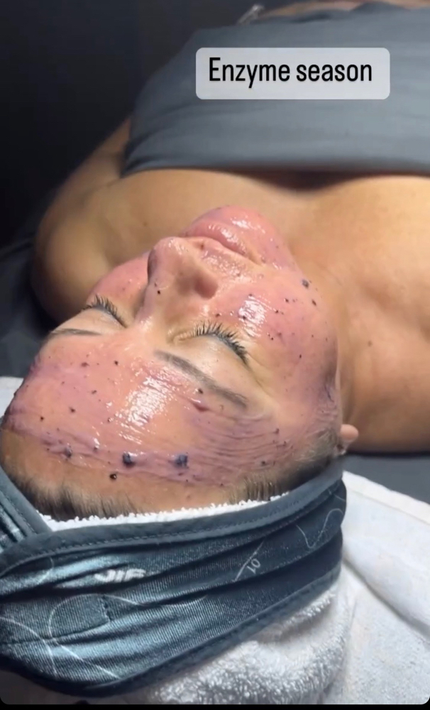Enzyme Facial