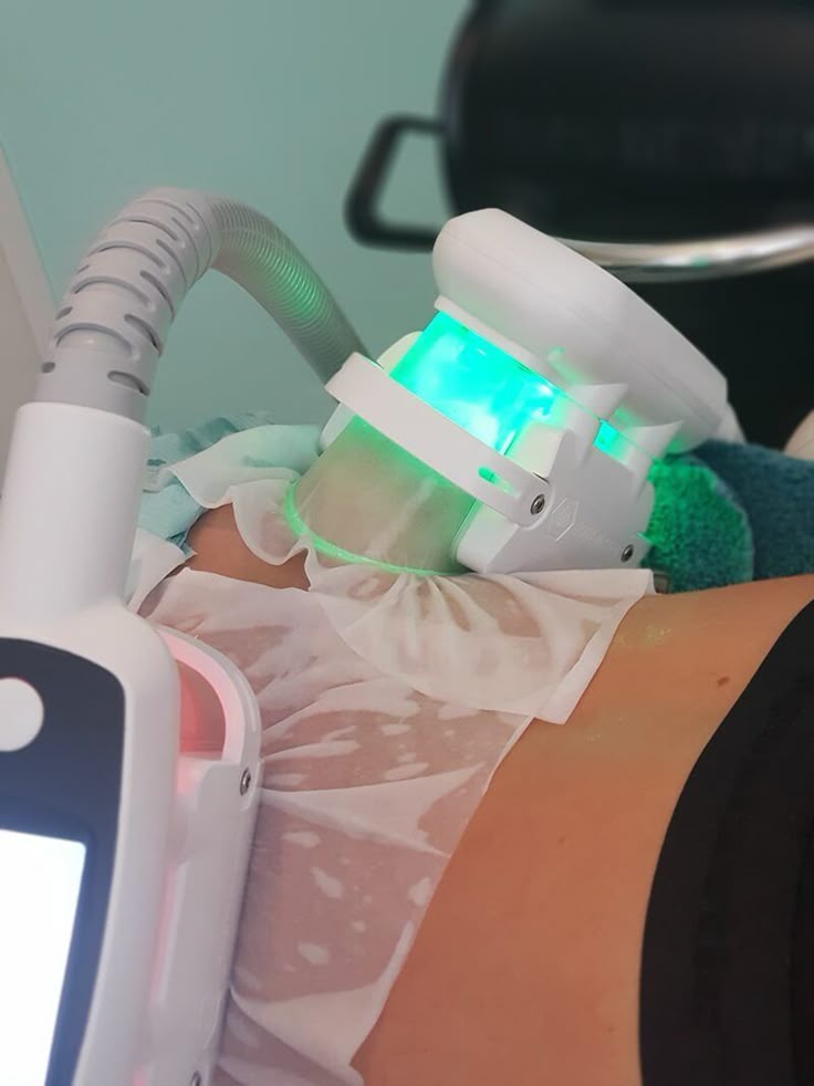 CoolSculpting at Lotus Beauty Center LLC in Eagle Pass, TX