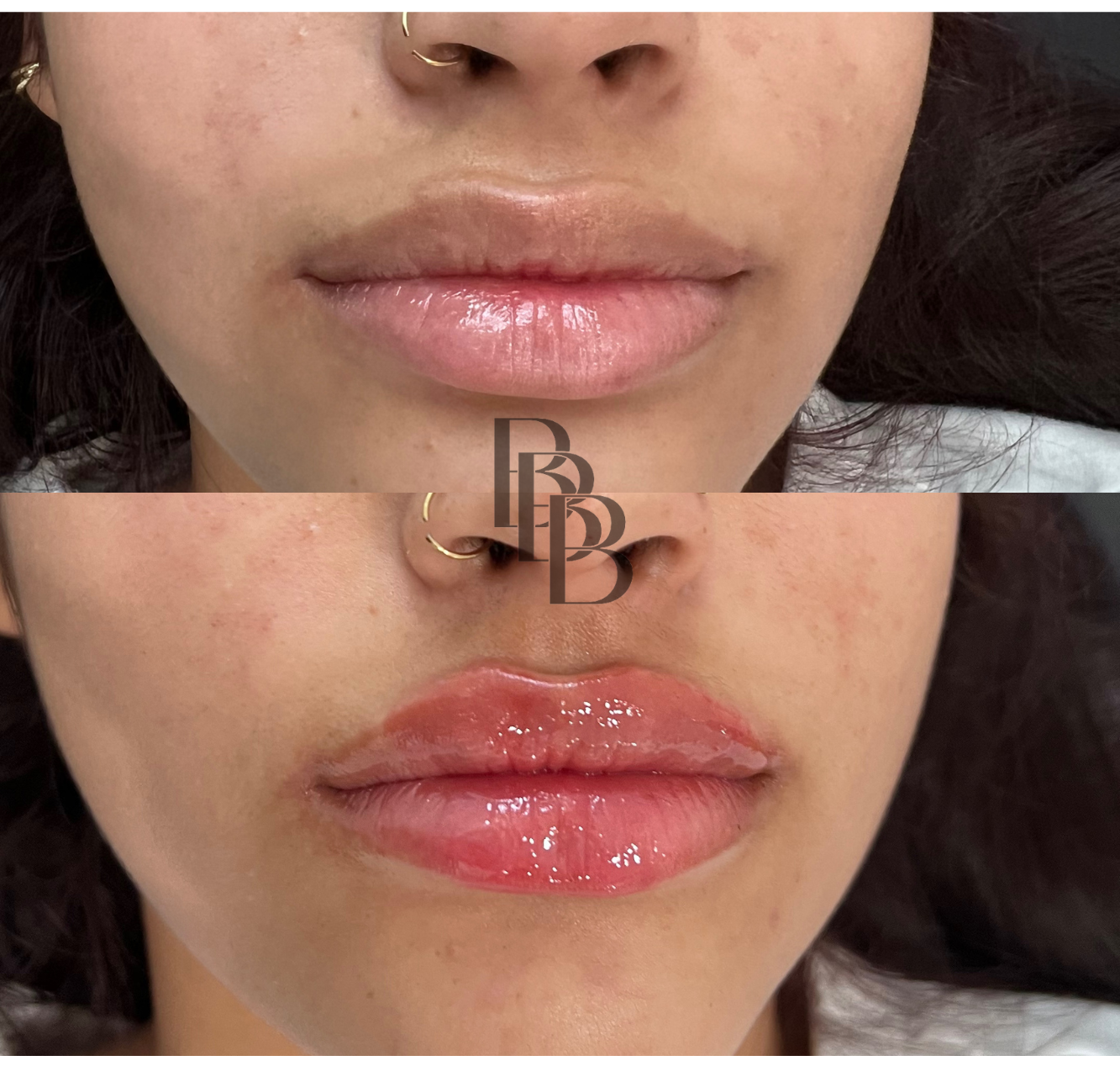 Mini Lip Plump