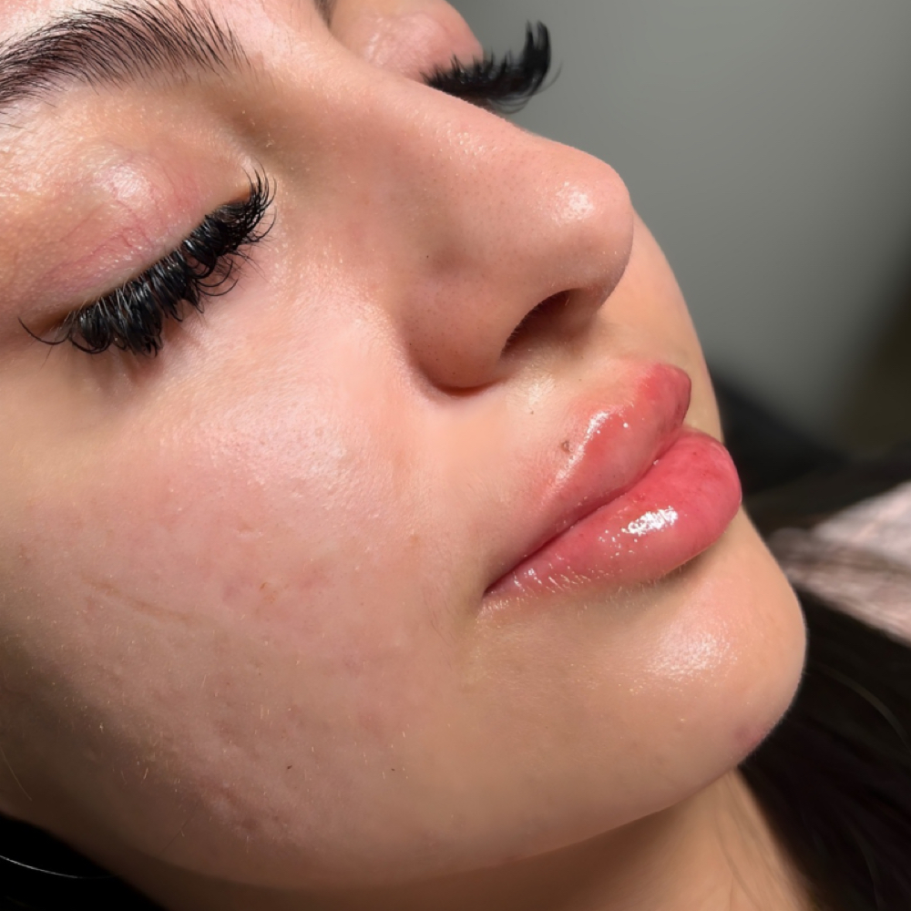 Mini Lip Plump at Baes Beauty Bar in Houston, TX