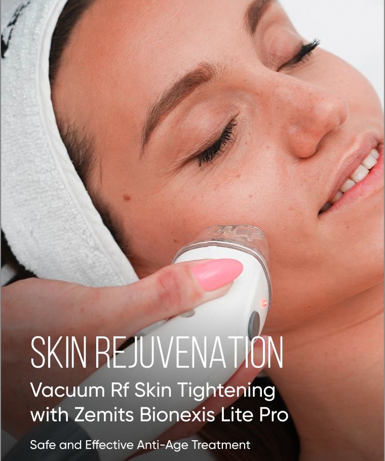 RF Facial Treatment
