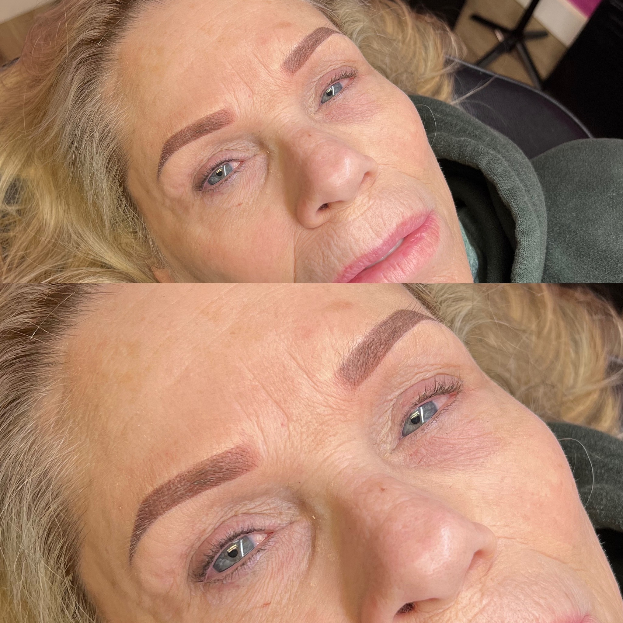 Brow Refinement/6 WeekFollow Up