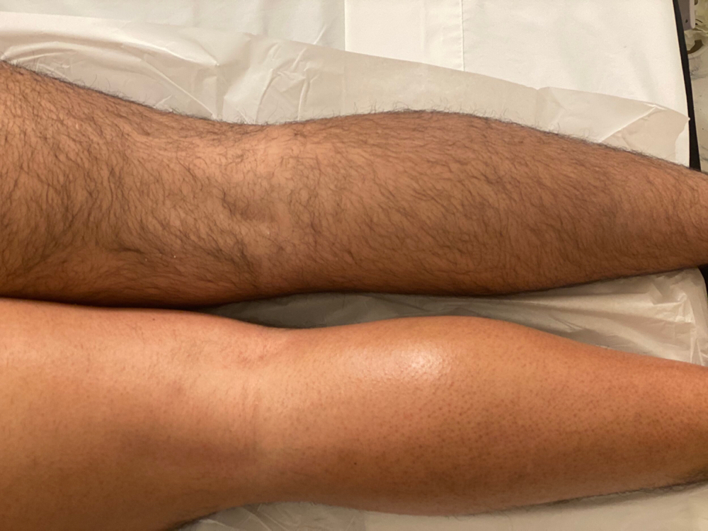 Full Leg