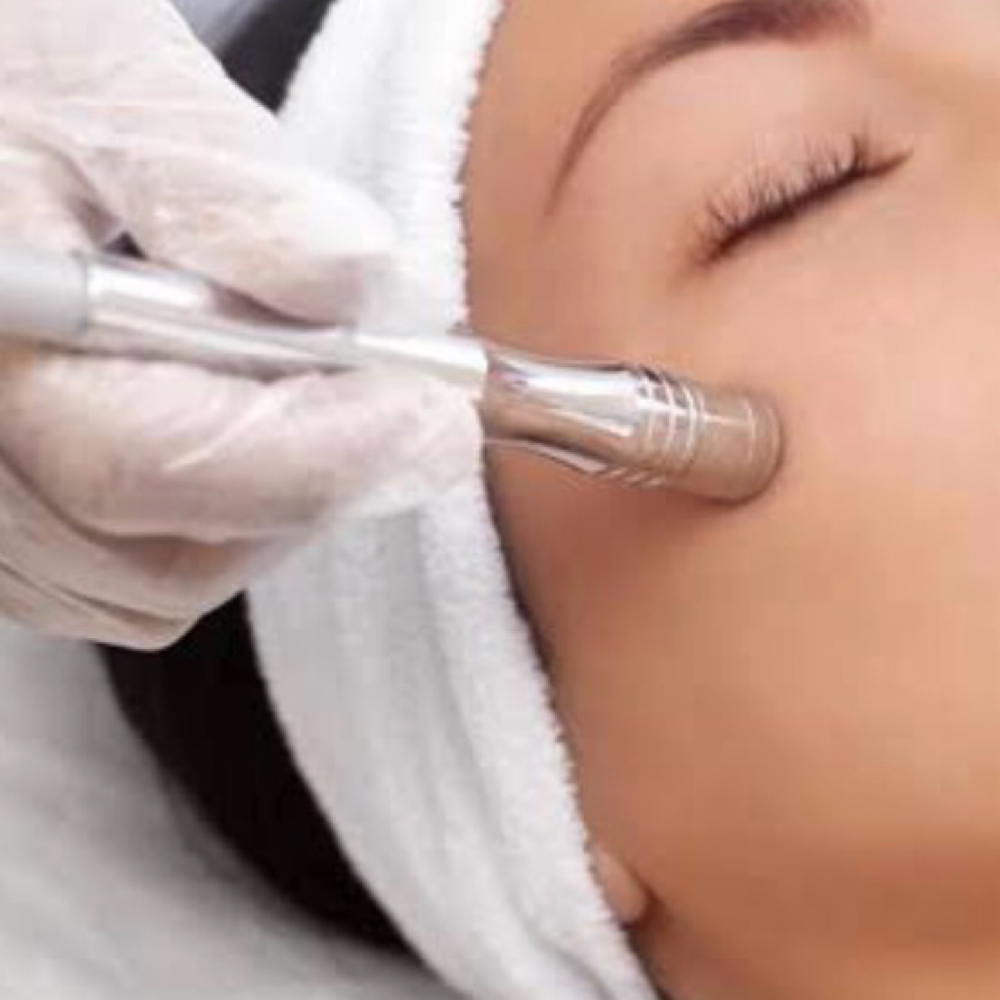 Microdermabrasion Facial at Lashed by Nat in Middletown, NY
