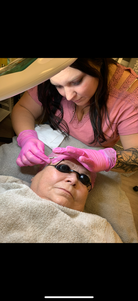 Dermaplaning Facial