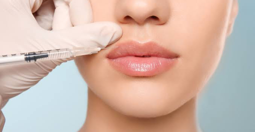 Natural lip Plump at Lavana Medspa in Edinburg, TX