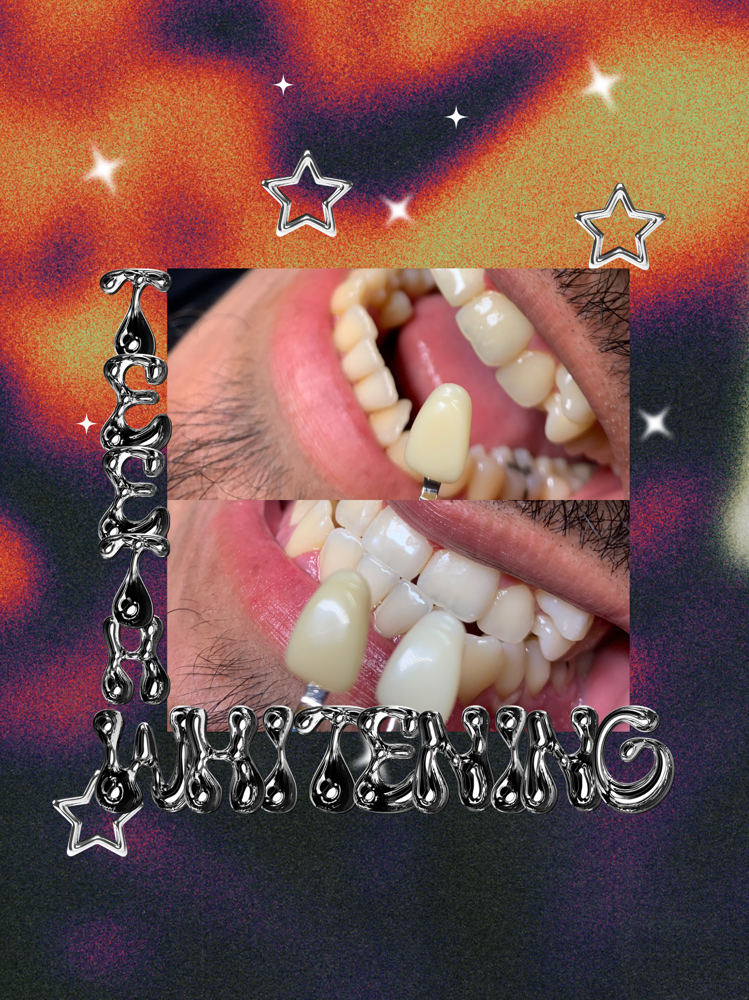 45 Min Teeth Whitening at Ethereal Beauty 444 LLC in Santa Ana, CA