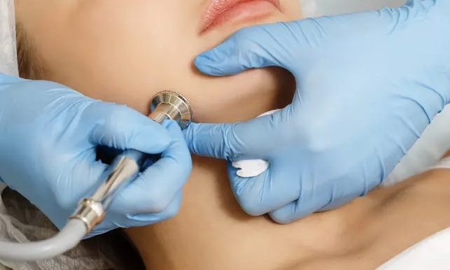 Microdermabrasion Facial