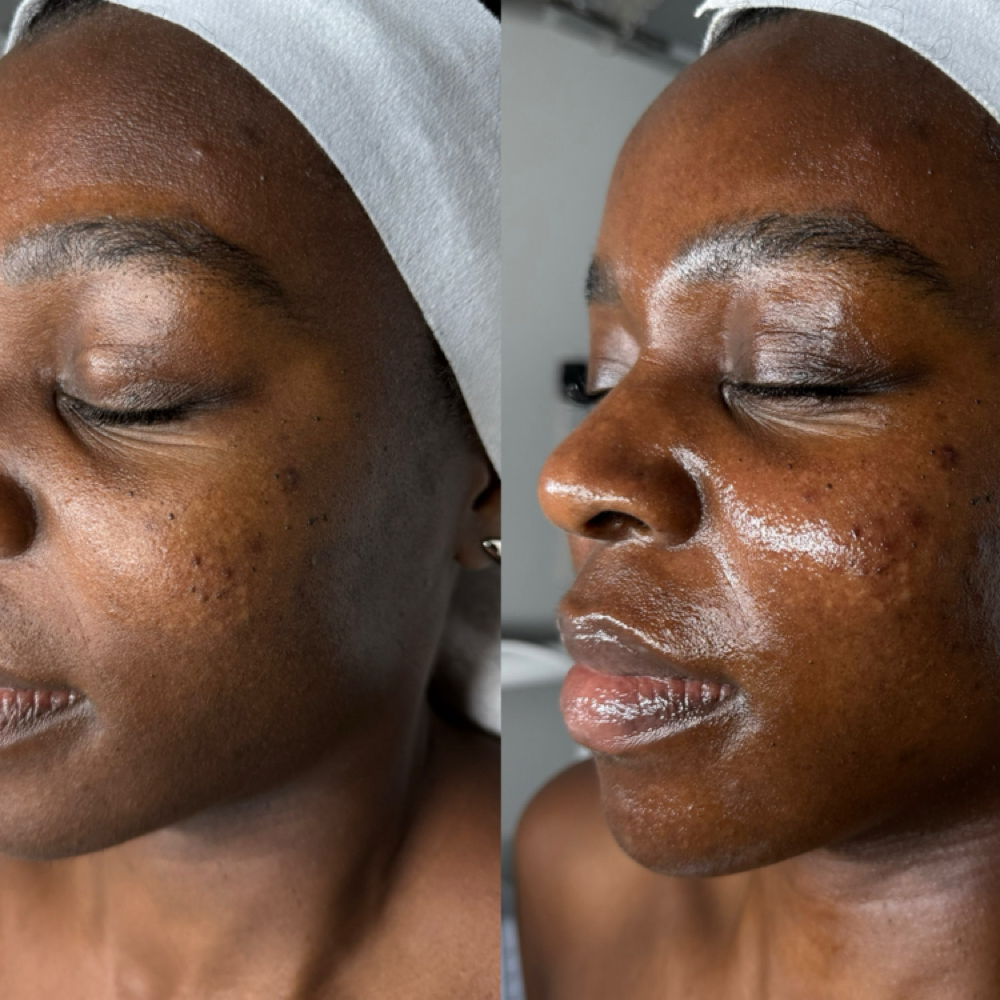 New Client All-Inclusive Facial at Oasiah Aesthetics in New York, NY