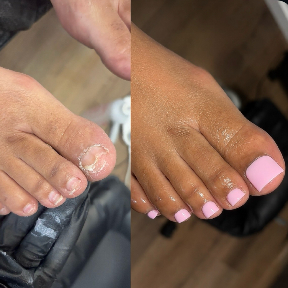 GEL-X TOE EXTENSIONS at Rich Muse Studio in Orlando, FL