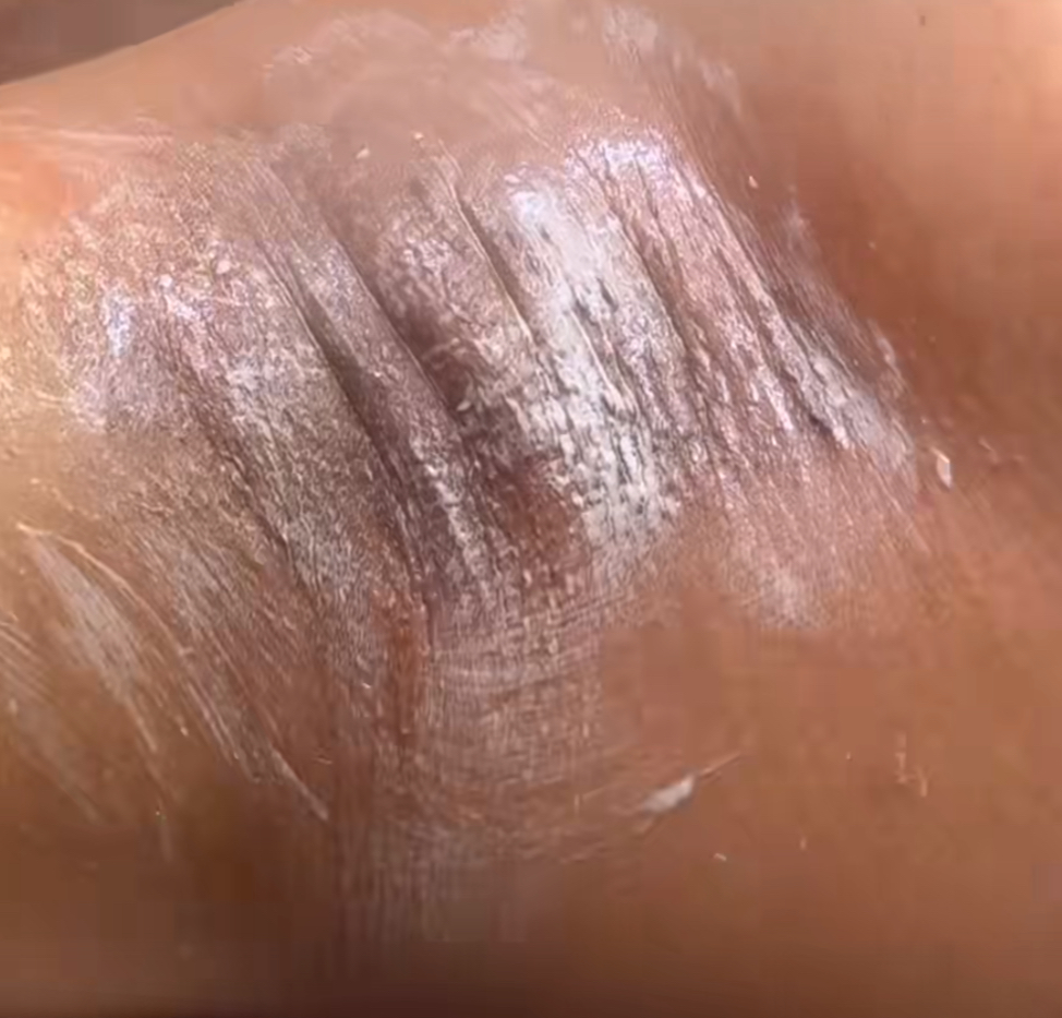 Underarm Lemon Detox at Ethereal Skin x Jenn in Bloomfield, NJ