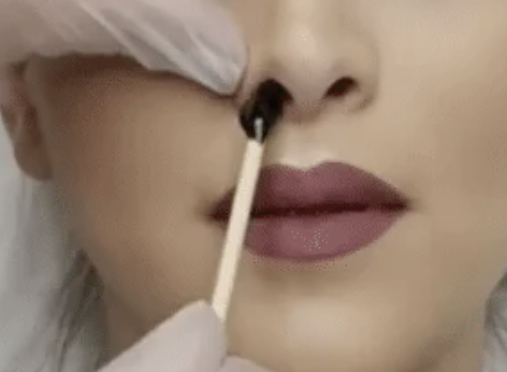 Nose Wax/ Nariz Con Cera