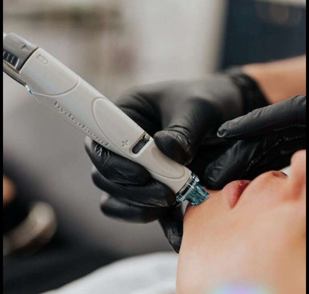 Hydra Facial Deep Cleanse at Lift Glow Beauty By Liz in Austin, TX