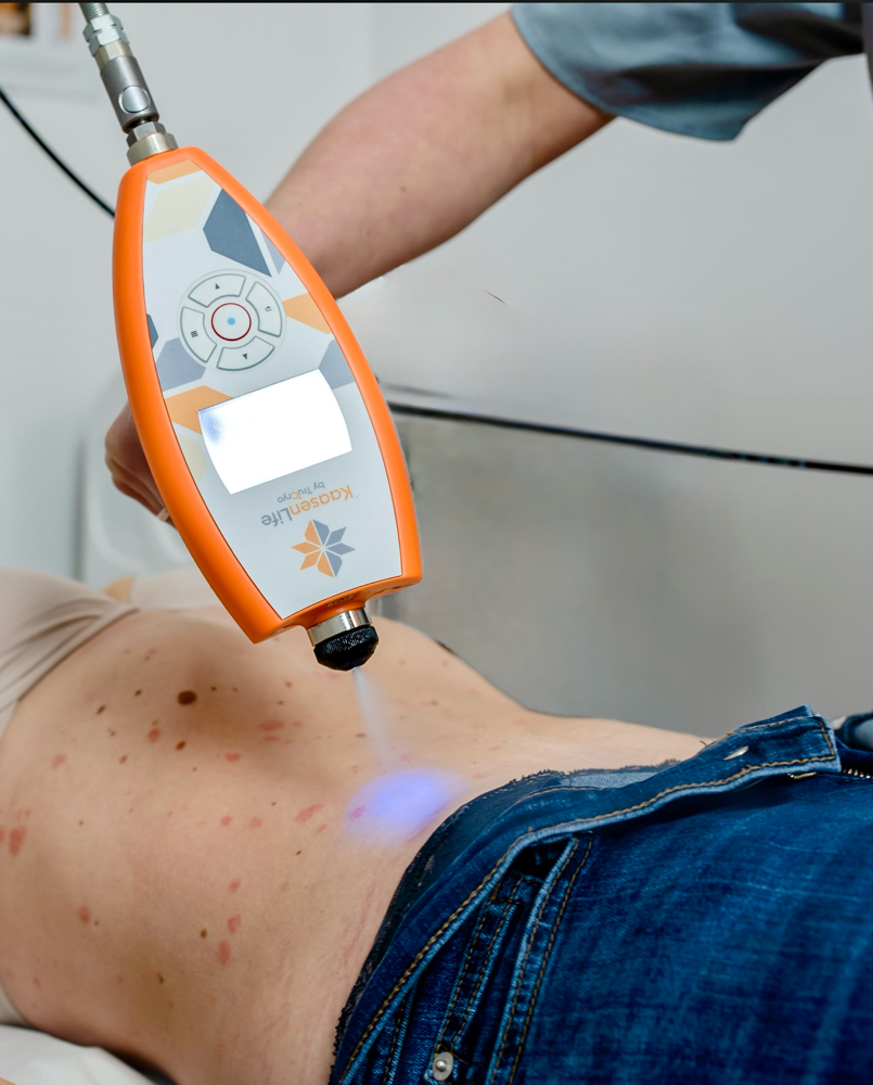 CryoSlimming - Small Area