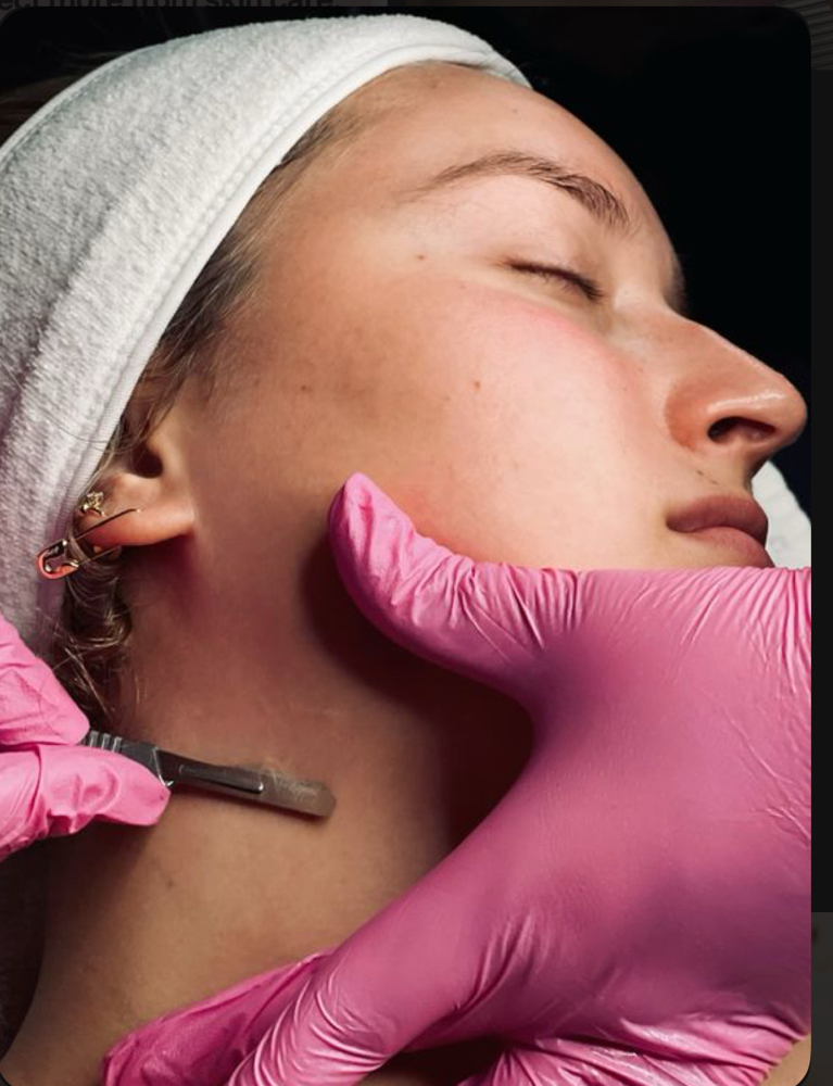 Dermaplaning at Lash by Ash in Tucson, AZ