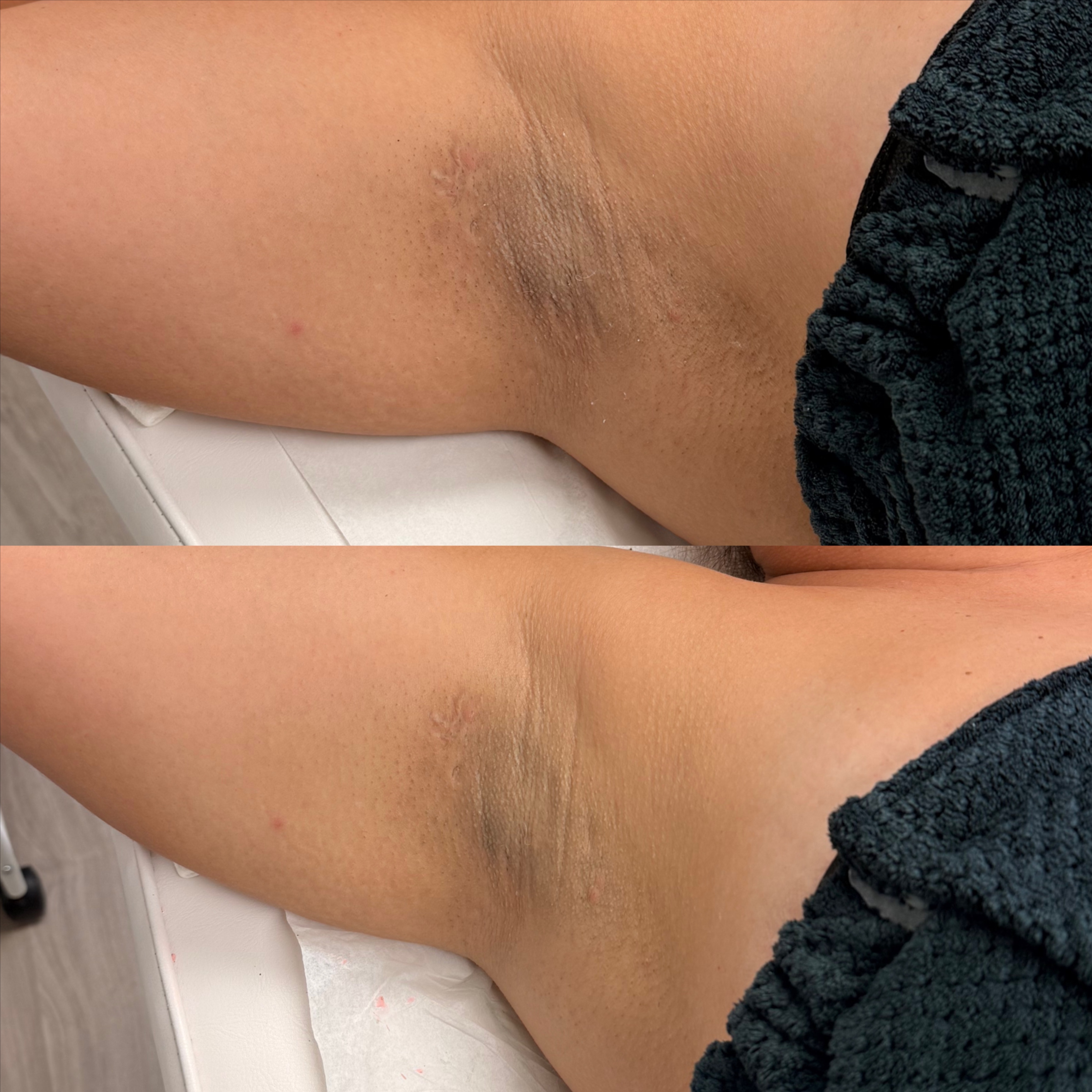 Intimate Clarifying Program at Andresa  Spillere Makeup And Beauty in Stoneham, MA