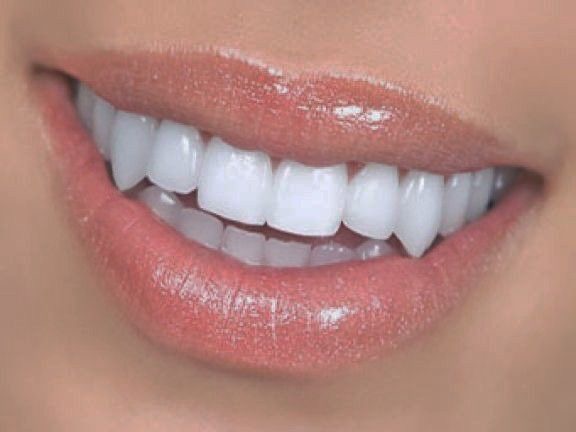 Vampire Fangs